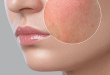 The Hydration Blueprint: Expert-Friendly Guide to Understanding & Treating Dry Skin