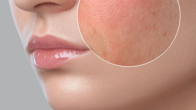 The Hydration Blueprint: Expert-Friendly Guide to Understanding & Treating Dry Skin