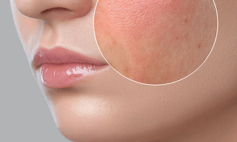 The Hydration Blueprint: Expert-Friendly Guide to Understanding & Treating Dry Skin
